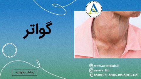 گواتر