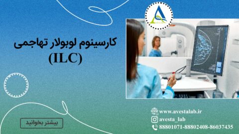 کارسینوم لوبولار تهاجمی (ILC)