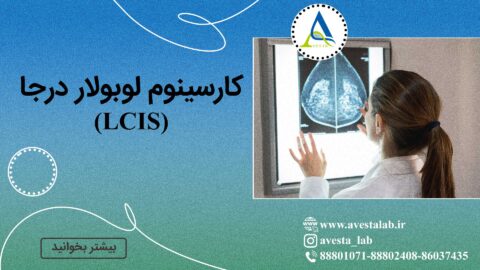 کارسینوم لوبولار درجا (LCIS)