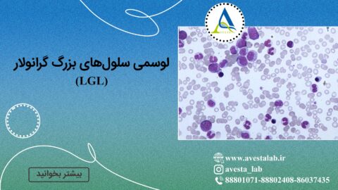 لوسمی سلول ‌های بزرگ گرانولار (LGL)