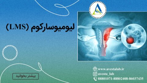 لیومیوسارکوم (LMS)