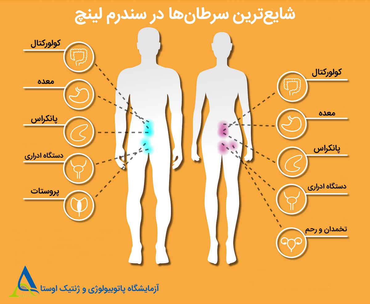 سندرم لینچ