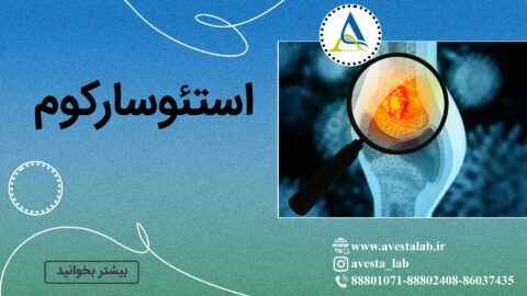 استئوسارکوم