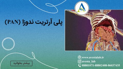 پلی آرتریت ندوزا (PAN)