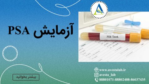 آزمایش PSA (آنتی‌ژن اختصاصی پروستات)