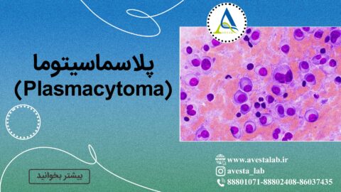 پلاسماسیتوما (Plasmacytoma)