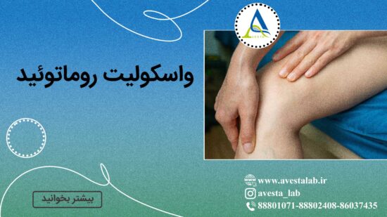 واسکولیت روماتوئید