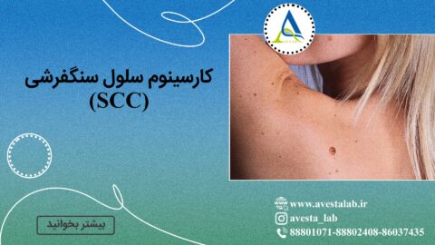 کارسینوم سلول سنگفرشی (SCC)