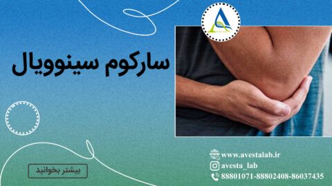 سارکوم سینوویال