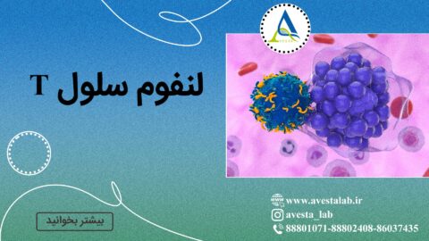 لنفوم سلول T