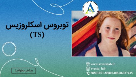 توبروس اسکلروزیس (TS)