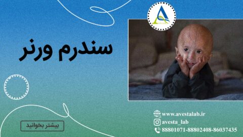 سندرم ورنر (Werner syndrome)