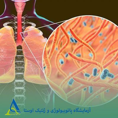 سیاه سرفه