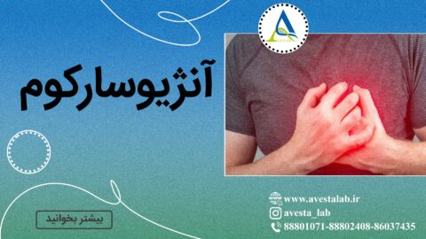 آنژیوسارکوم