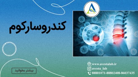 کندروسارکوم