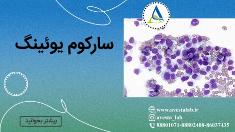 سارکوم یوئینگ