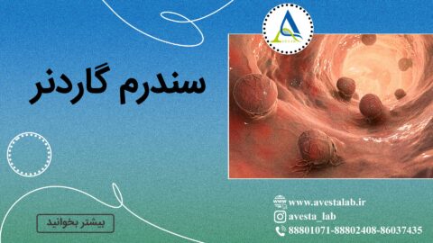 سندرم گاردنر