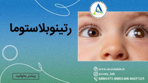 رتینوبلاستوما