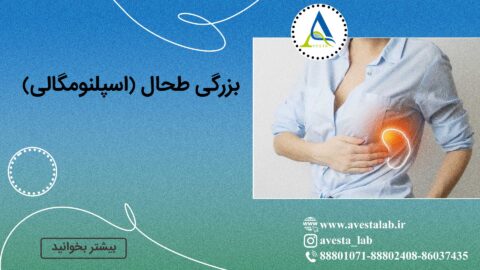 بزرگی طحال (اسپلنومگالی)