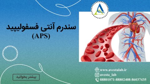 سندرم آنتی فسفولیپید (APS)