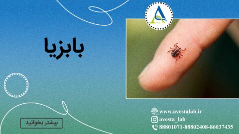 بابزیا