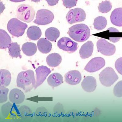 بابزیا