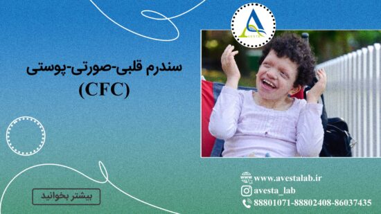 سندرم قلبی-صورتی-پوستی (CFC)