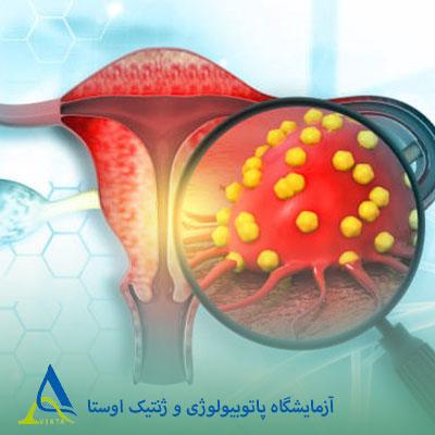 آزمایش HE4 و کاربرد آن