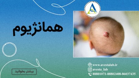 همانژیوم