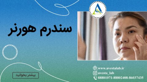 سندرم هورنر