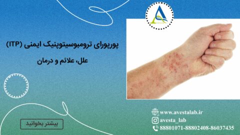 پورپورای ترومبوسیتوپنیک ایمنی (ITP)؛ علل، علائم و درمان