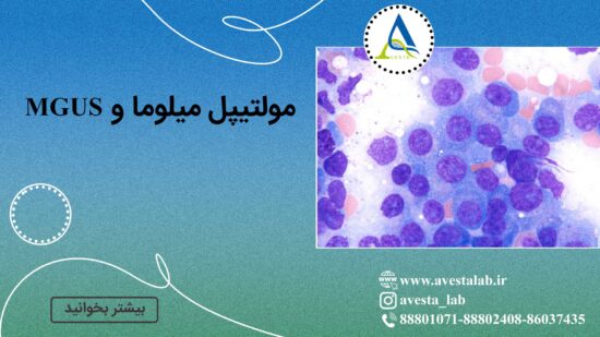 مولتیپل میلوما و MGUS