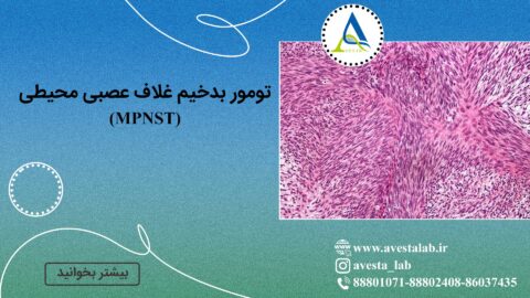تومور بدخیم غلاف عصبی محیطی (MPNST)