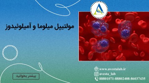 مولتیپل میلوما و آمیلوئیدوز