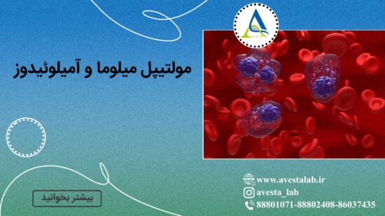 مولتیپل میلوما و آمیلوئیدوز
