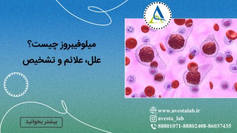 میلوفیبروز چیست؟ علل، علائم و تشخیص