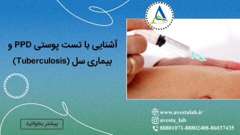 آشنایی با تست پوستی PPD و بیماری سل (Tuberculosis)