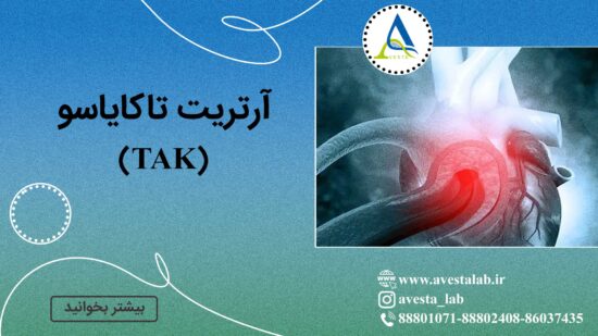 آرتریت تاکایاسو (TAK)