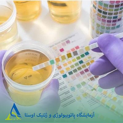 آزمایش ادرار (Urinalysis)؛ تفسیر کامل نتایج