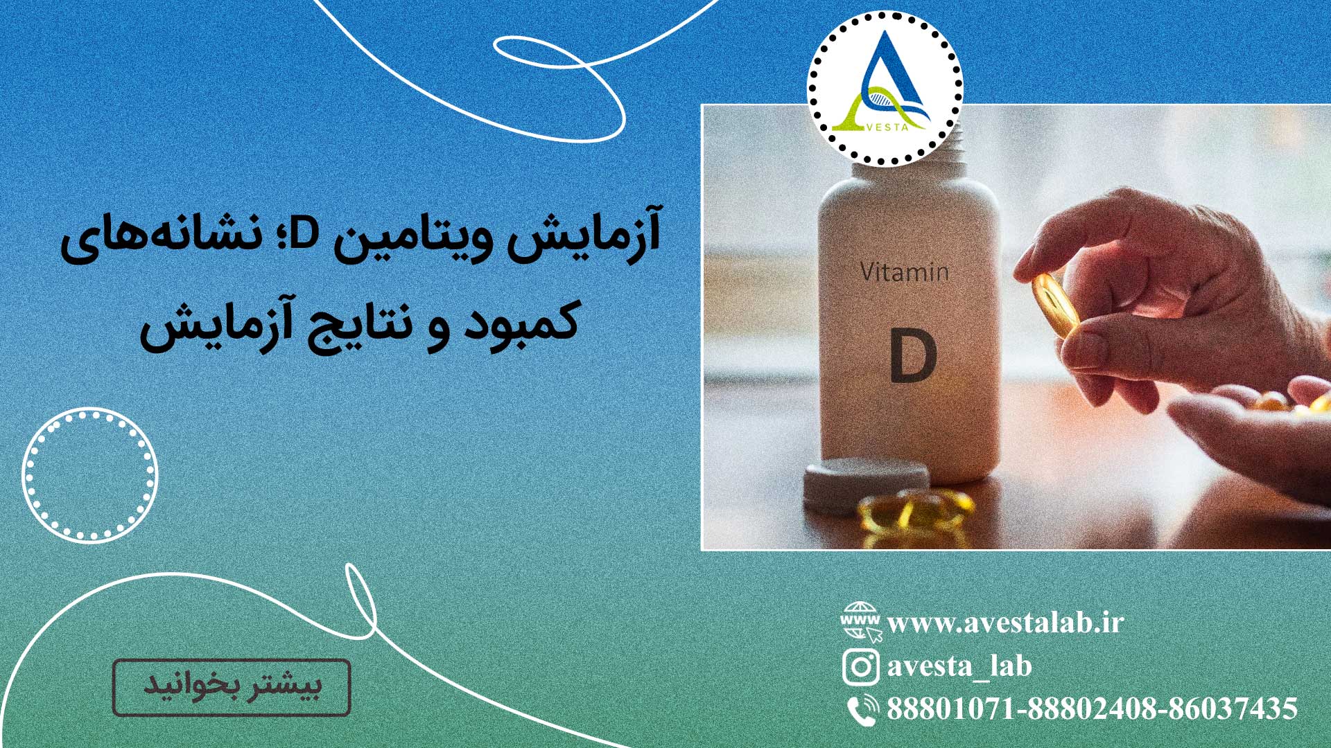 آزمایش ویتامین D؛ نشانه های کمبود و نتایج آزمایش