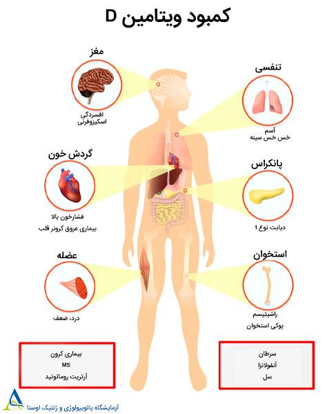 آزمایش ویتامین D؛ نشانه های کمبود و نتایج آزمایش
