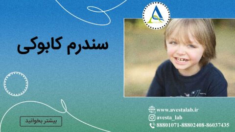 سندرم کابوکی