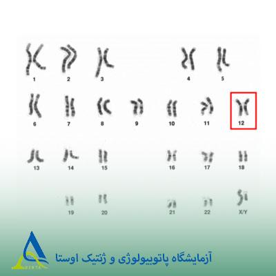 سندرم کابوکی