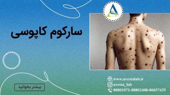سارکوم کاپوسی