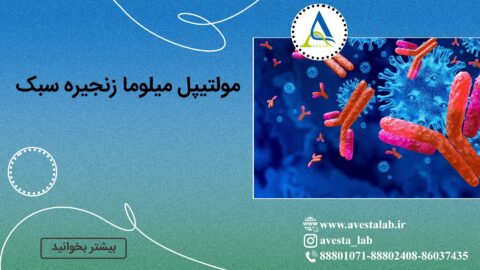 مولتیپل میلوما زنجیره سبک