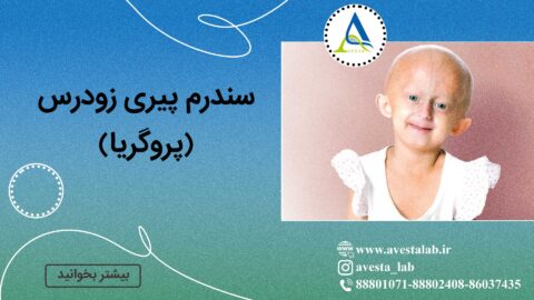 سندرم پیری زودرس (پروگریا)