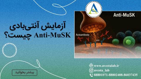 آزمایش آنتی‌بادی Anti-MuSK چیست؟