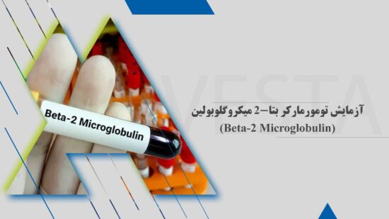 آزمایش تومورمارکر بتا-2 میکروگلوبولین (Beta-2 Microglobulin)