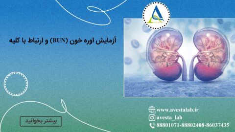 آزمایش اوره خون (BUN) و ارتباط با کلیه