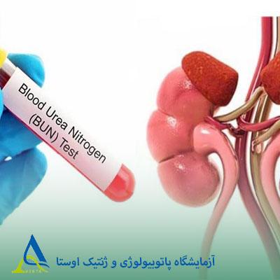 آزمایش اوره خون (BUN) و ارتباط با کلیه